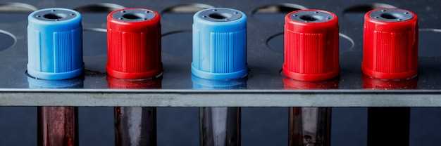 Признаки неисправности реле генератора